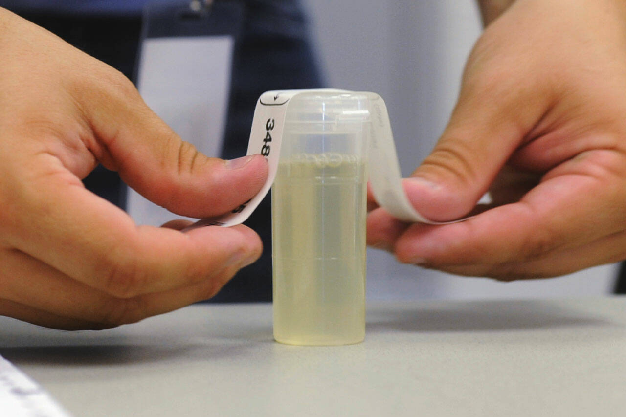 Best Synthetic Urine for Lab Drug Tests: Effective Fake Pee Kits to Use |  Bothell-Kenmore Reporter