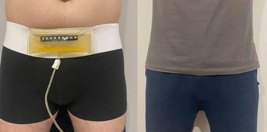 Best Synthetic Urine for Lab Drug Tests Effective Fake Pee Kits to Try