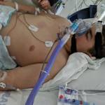 Anthony Lawson, 13, in the hospital while he fought pediatric multisystem inflammatory syndrome (PMIS). Photo courtesy of Theresa Lawson.